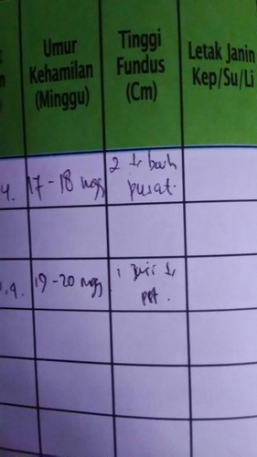 tinggi fundus