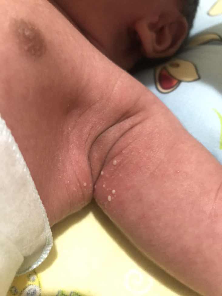 Bintik Kecil2 Melenting