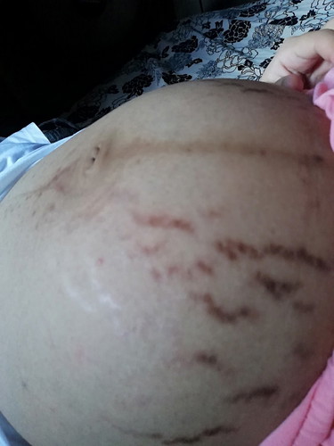 34 Weeks And Day 1