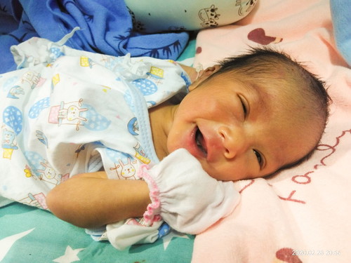 คลอดก่อนกำหนด35w