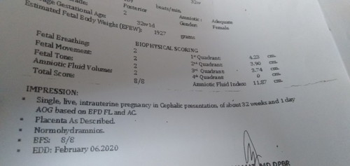 my second ultrasound.