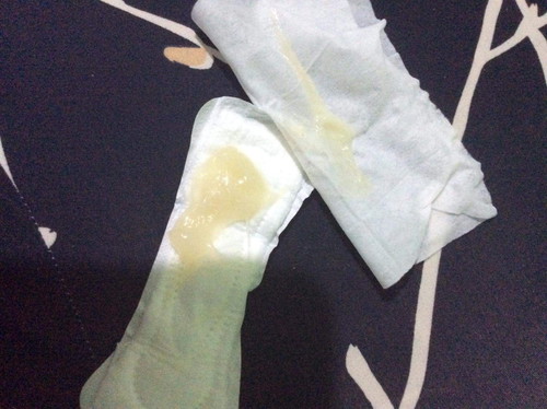 Frustration