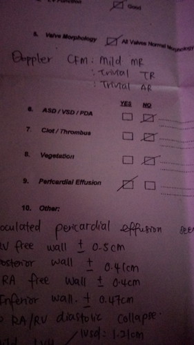 pericardial effusion