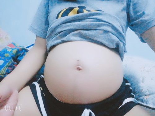 ท้องหลังคลอด...ท้องมันจะลายใช่ไหมค่ะ?