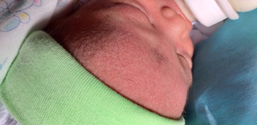 ลกได้5วัน