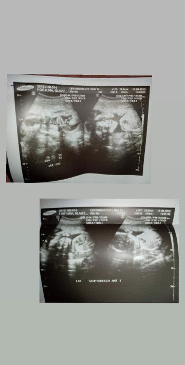 Glaizza Mae Fortuna profile icon