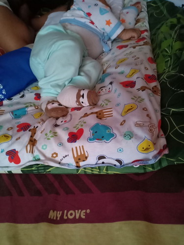 bayi umur 3 bulan suka tidur miring..