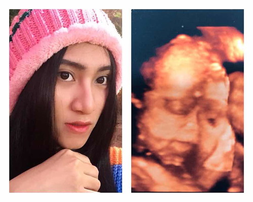 ทีมมีนาคม63