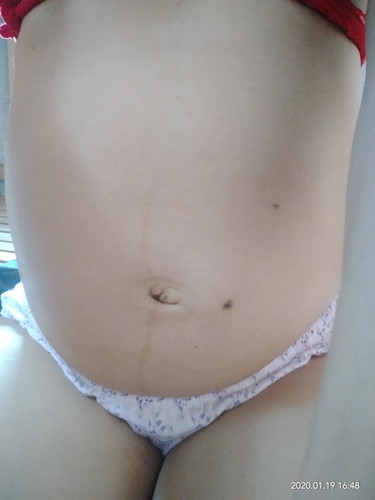 kailan po magkaroon ng gatas kapag buntis?