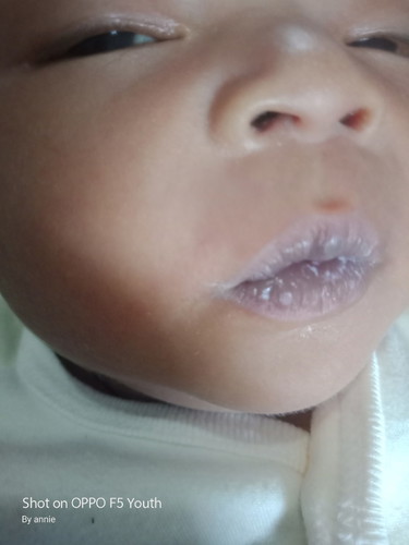 lidah dan bibir bayi