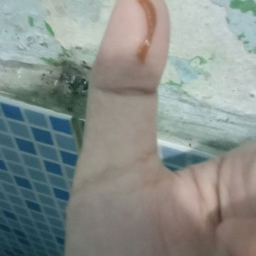 Flek atau apa ya ini