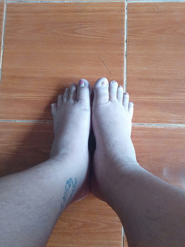 เดินไม่ไหวนอนไม่ได้ปวดร้าวไปหมด