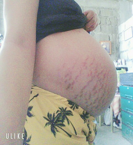 38 weeks and 3 days