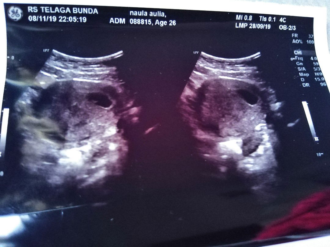 Beda DR Beda Diagnosa