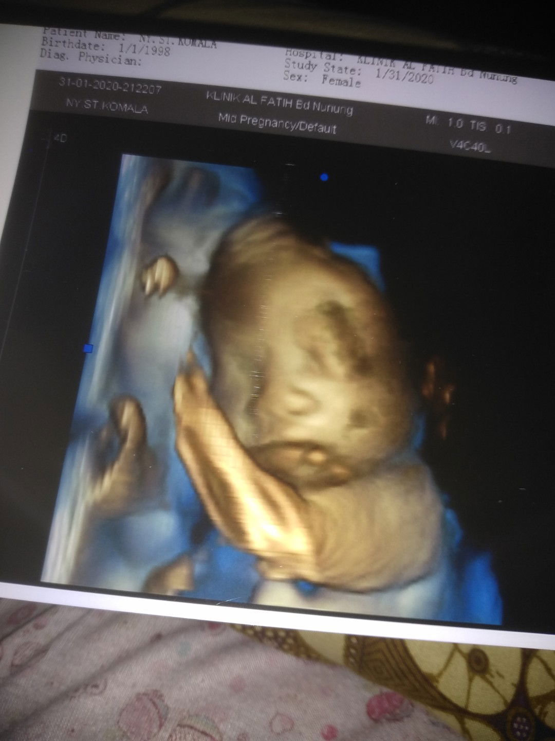 detak jantung bayi tinggi