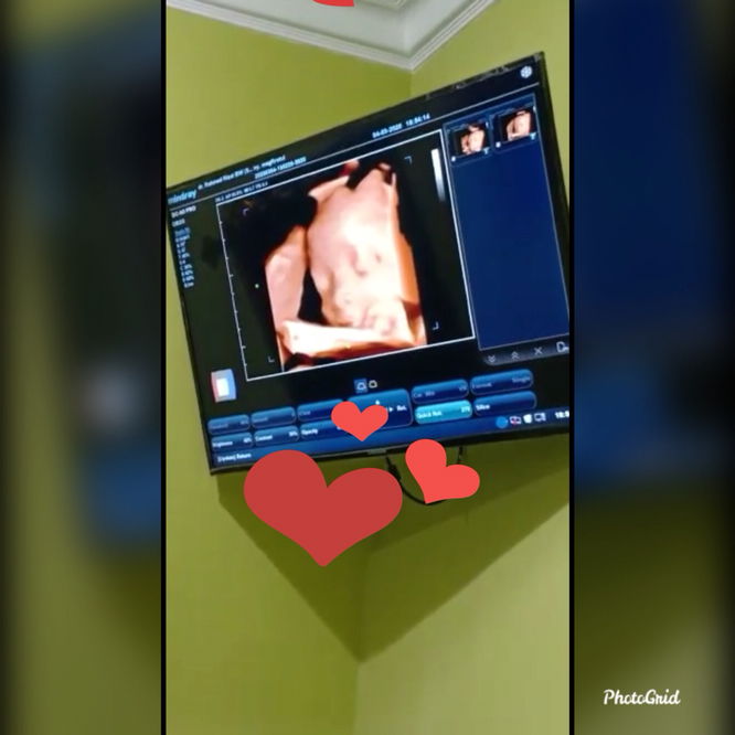 Perlengkapan Melahirkan