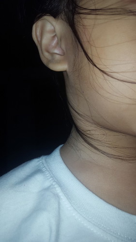 kulani o beke? o iba pa