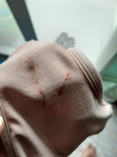 มูกเลือด?