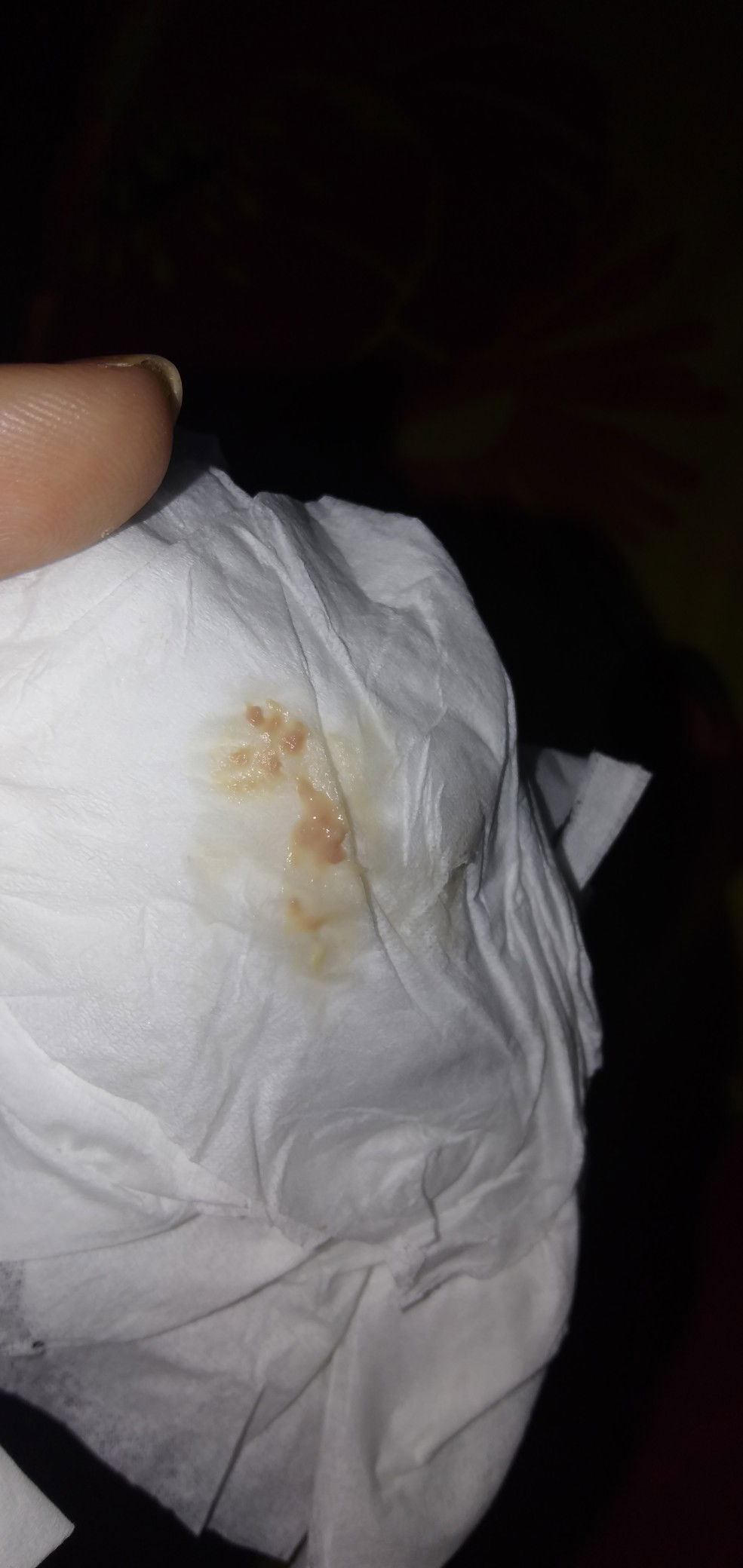 keputihan apa bercak?