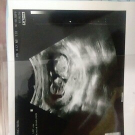 ลูกน้อย