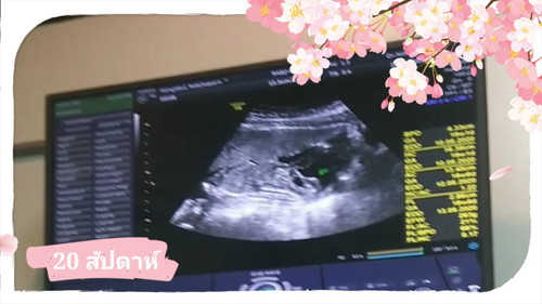 ห่างแม้เพียงกายแต่ใจไม่ห่างเลย