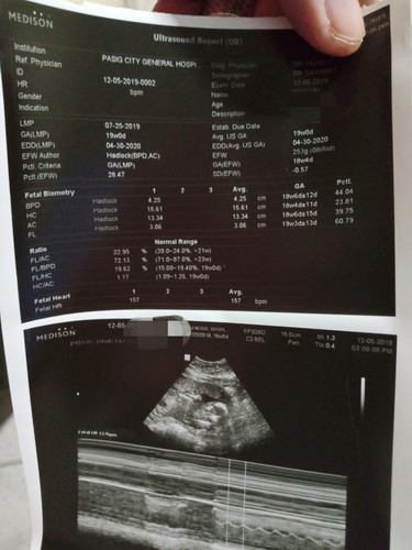 Ultrasound
