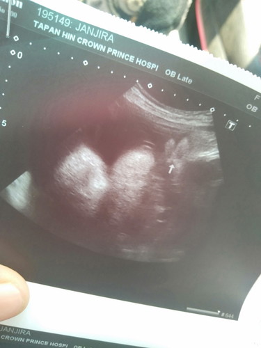 ใครดูออกชัวไหมค่ะ