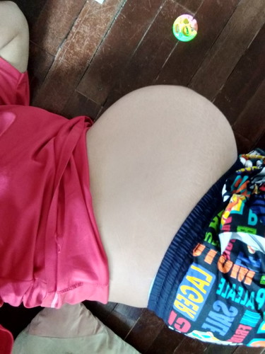 แม่ๆที่เคยผ่าคลอดน่ากลัวไหมค่ะ