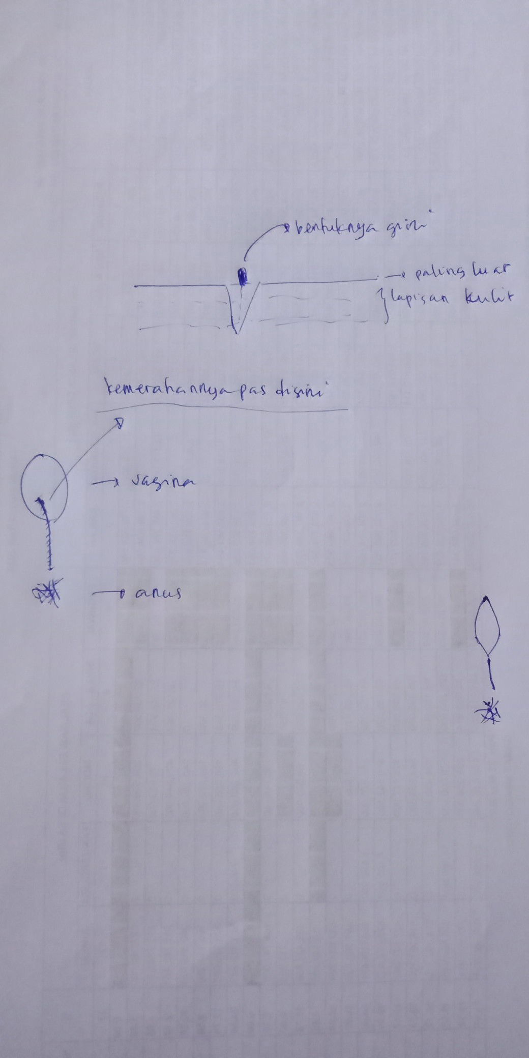 Jahitan Perenium muncul kemerahan