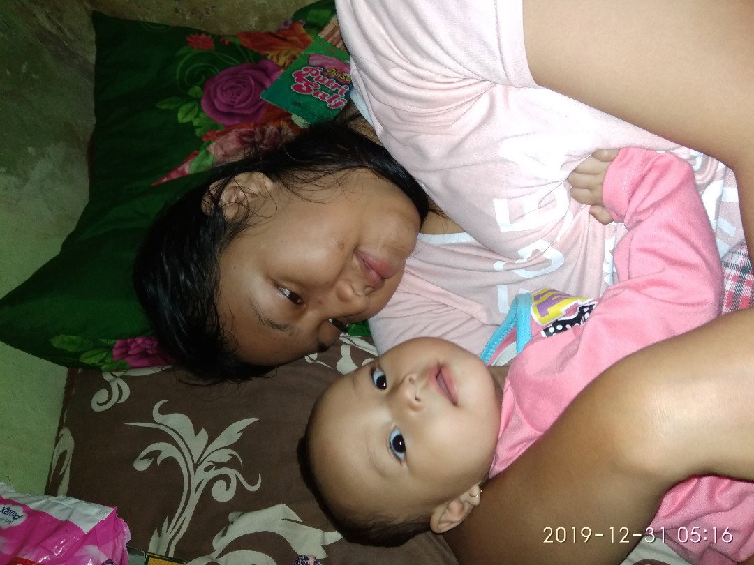 gigit puting