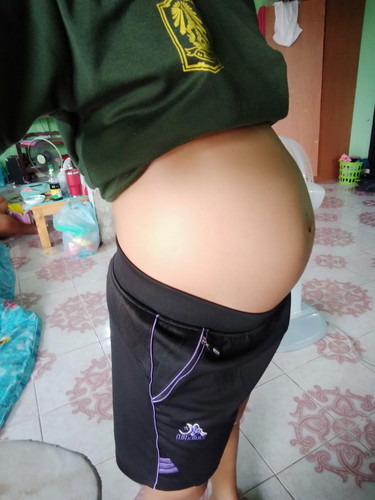 ท้องแบบนี้ หญิงหรือชายค่ะ