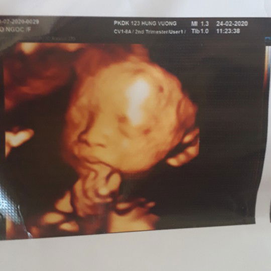 k biết mắt e có to k mom