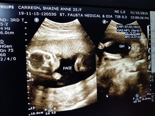 19 weeks and 4 days.