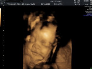 flex ko lang ang baby girl ko