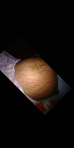 เครียดด
