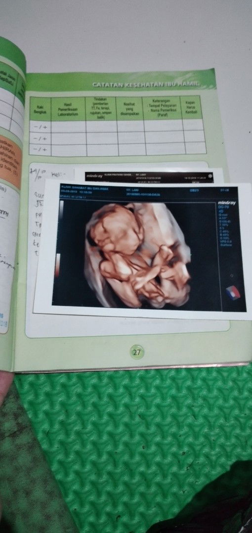 kehamilan