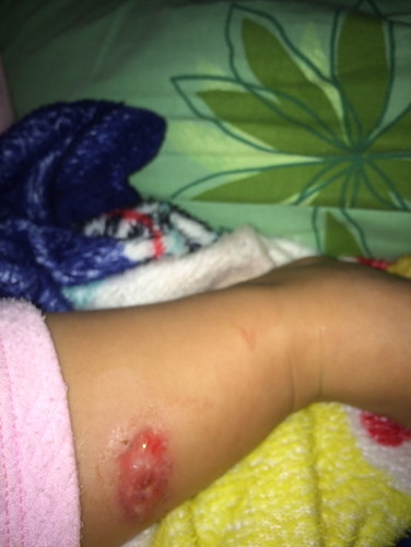 ขออภัยด้วยนะคะถ้ารูปภาพนี้อาจไม่เหมาะสม