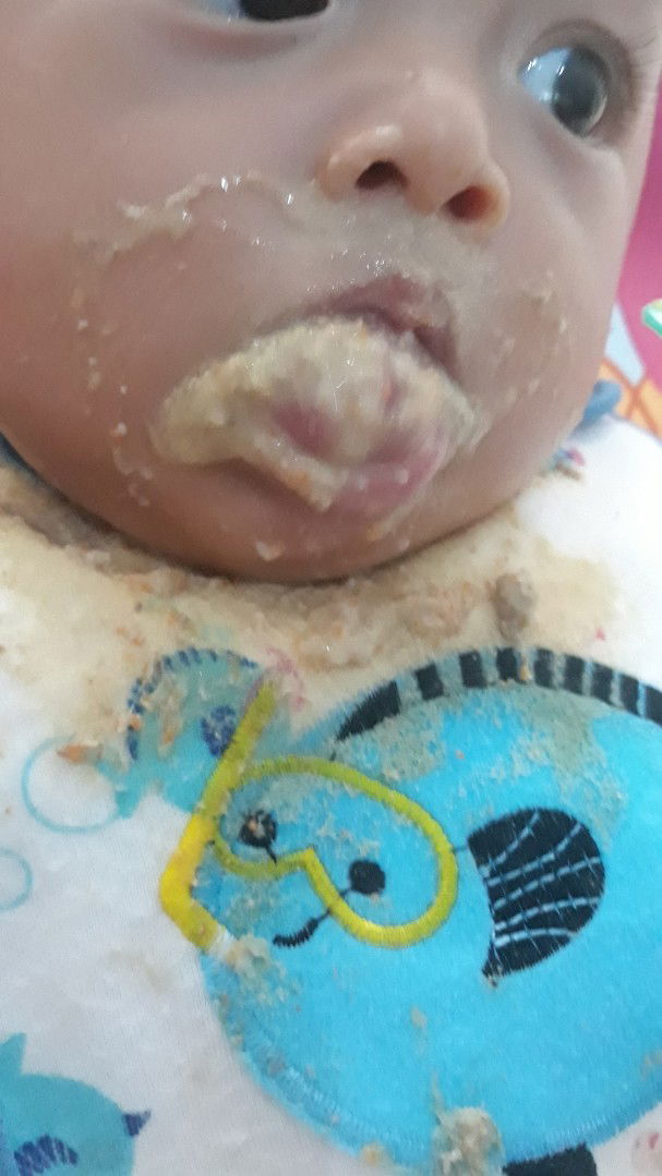 melet pada saat makan