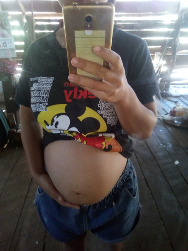 ชอบมีคนทักว่าท้องต่ำ