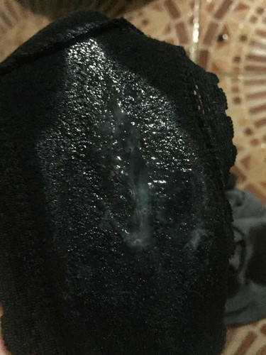 ตกขาวหรือมูก