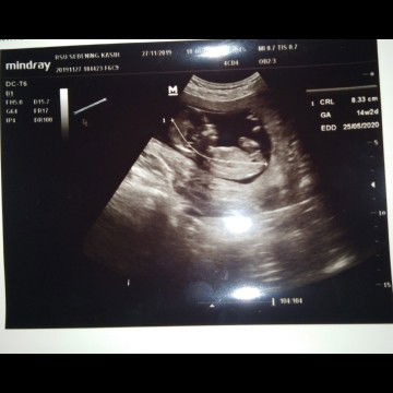 15W (HPL MEI 2020) ♥  Sharing yuk! ♥