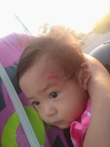 ลูกสาวชอบล้มหัวฝาดพื้น มีวิธีหรือการสังเกตุอาการผิดปกติยังไงคะรอบนี้ตกบันได เปนมา4วันแล้วอยากไปหาหมอแต่ลูกก็ดูปกติดี กลุ้ม