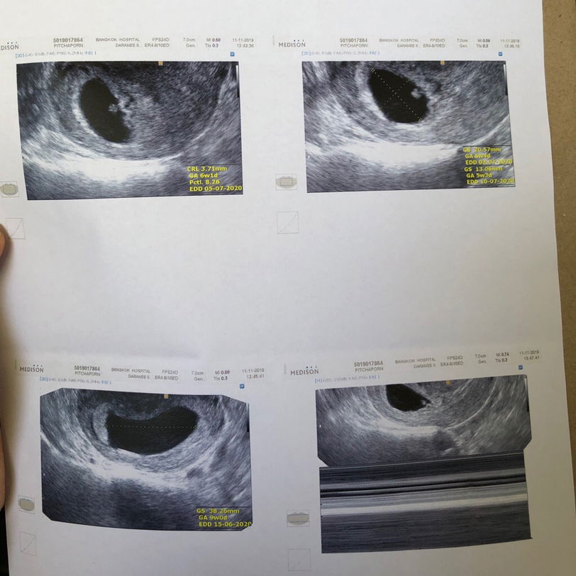 คงไม่ได้เจอกันแล้ว ..