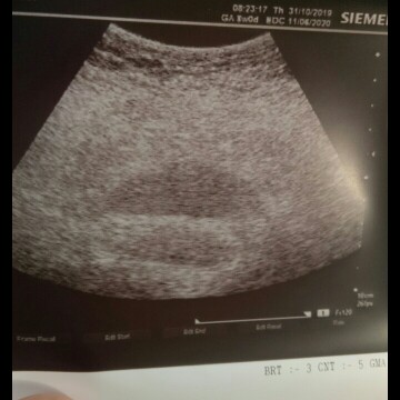 normal ke 8week xnmpak ape timw scan