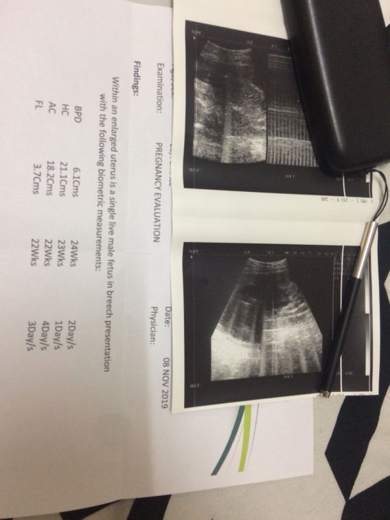 Determining genderrr