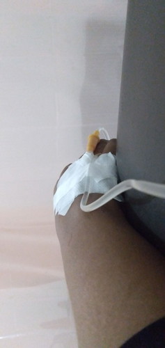 hamil 37 minggu jatuh d tangga