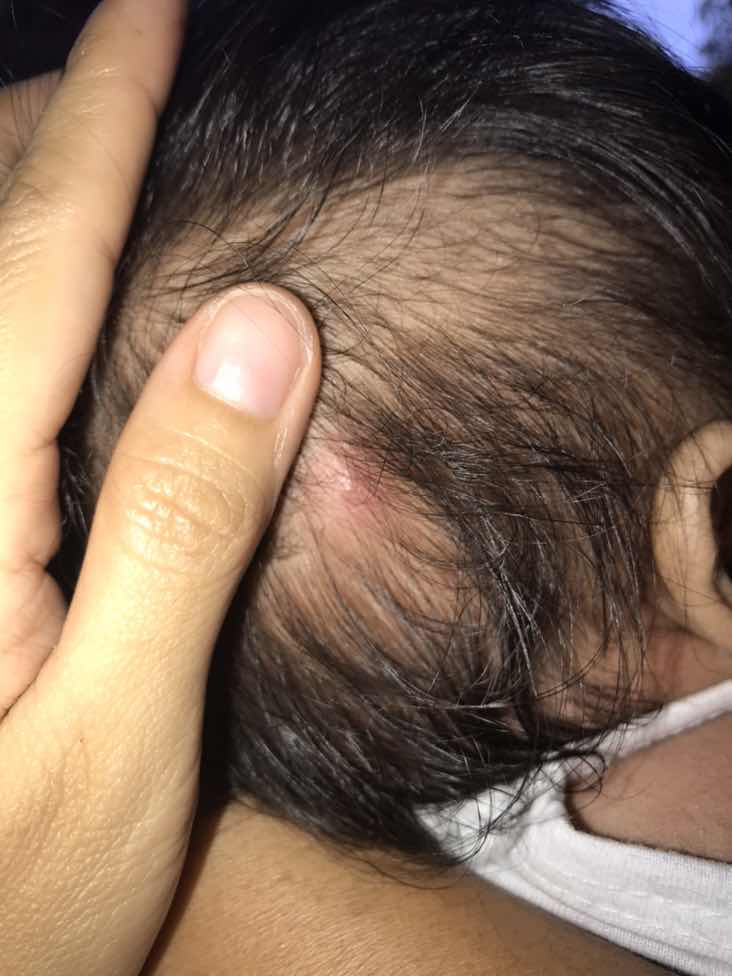 pls comment sa nakaranas ganto baby nila