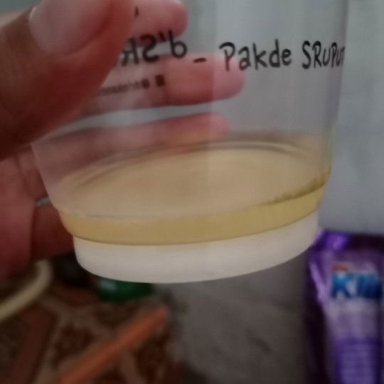 tes kehamilan pakai urine + garam