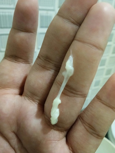 White discharge