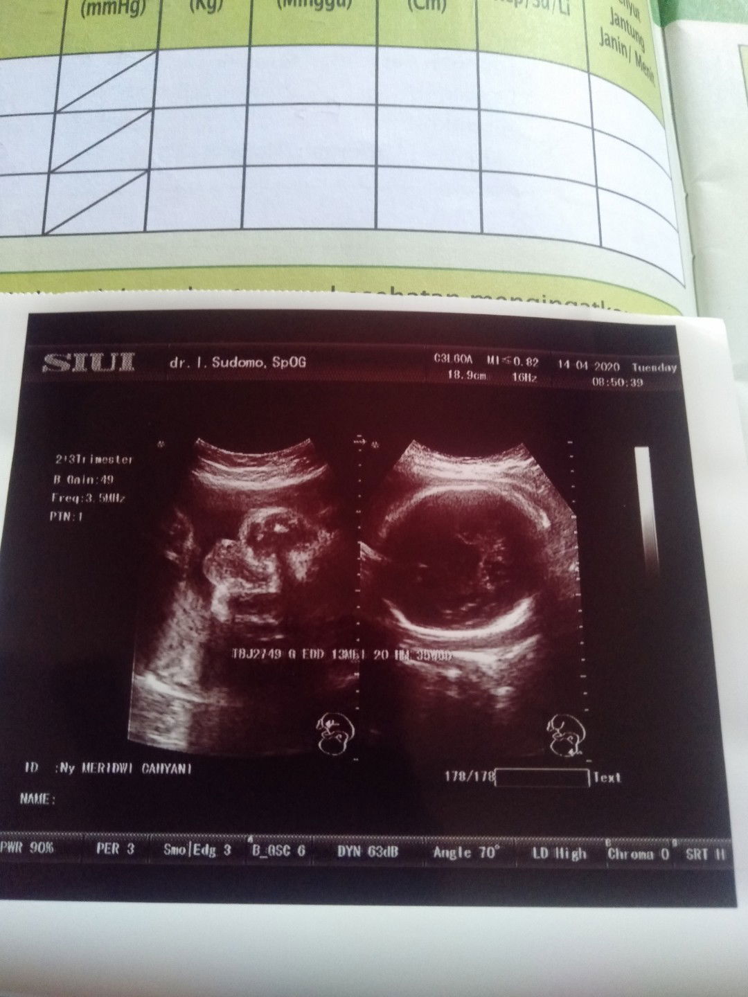 Kepleset Di kamar mandi